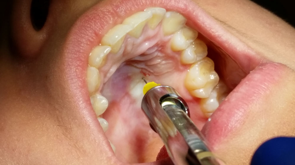 HIT ME WITH YOUR BEST SHOT THE AMSA