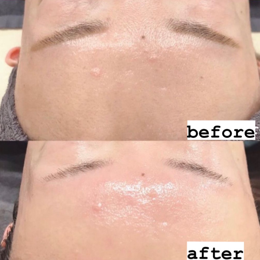 パッと明るく透明感のある肌へ