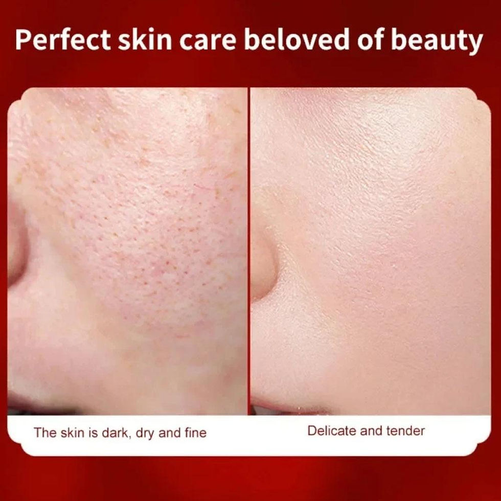 Thumbnail: Retinol Dragon Blood Facial Cream Moisturize Repair Whiten Concealer Fine Lines 
