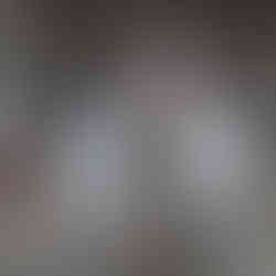 توريد وتركيب شبك