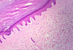 Epitelio plano estratificado