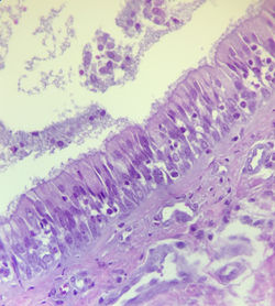 Epitelio cilíndrico pseudoestratific