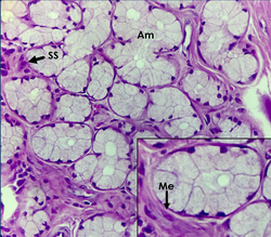 Glándula Sublingual 1