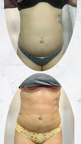 weight loss gallery photo