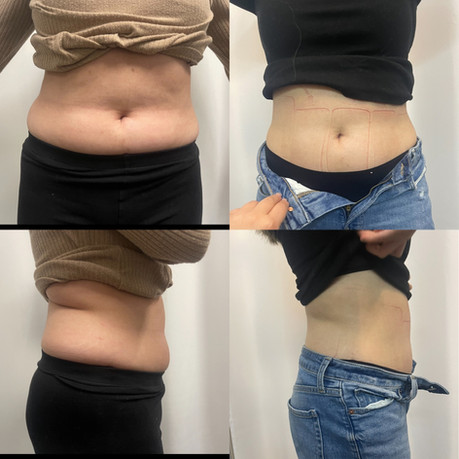 weight loss gallery photo