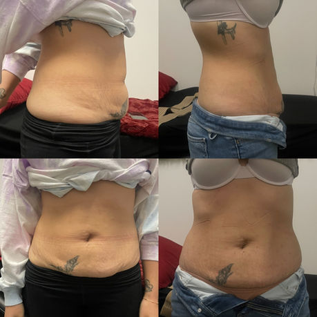 weight loss gallery photo
