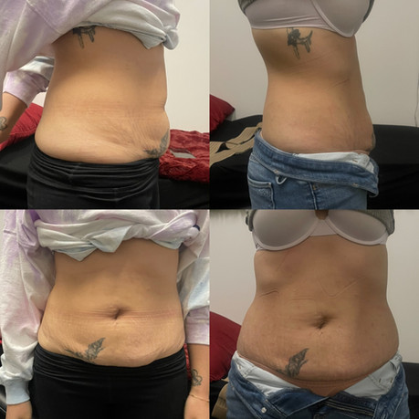weight loss gallery photo
