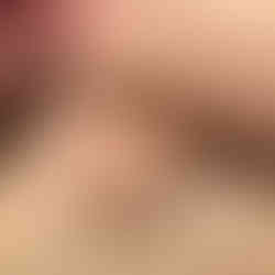 Mister Limpy M, closeup of the balls