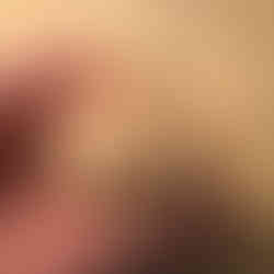 closeup van de ballen