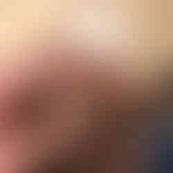 Tommy STP closeup eikel, plasgat open