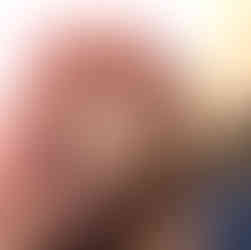 Tommy STP closeup eikel, plasgat dicht