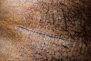 Virus, fungi, flesh, why personal_