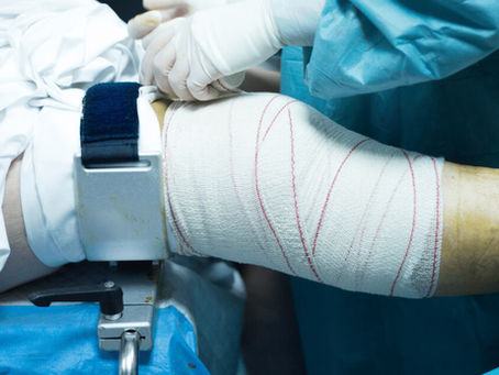 Knee Surgery