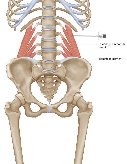 Your QL Might Be The Reason Your Back Hurts - Massage Saffron Walden.
