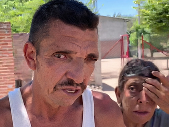 Cobra su pensión y la abandona: hermana deja a mujer con ceguera y discapacidad mental sin un peso con otro familiar
