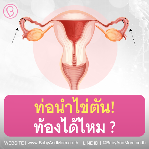 ท่อนำไข่ตันท้องได้ไหม❓