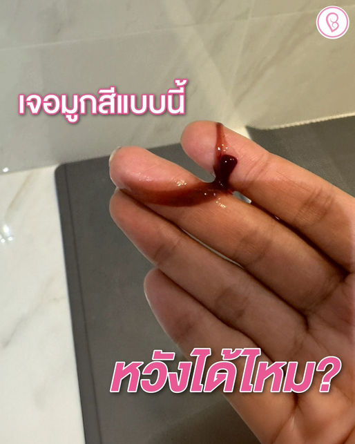ใส่ตัวอ่อนได้ 14 วัน มีมูกเลือดออกมาแบบนี้ ยังมีหวังไหม?