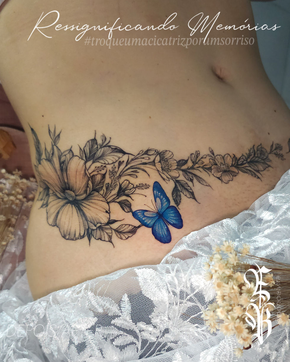 Tatuagem reparadora para cobertura de cicatriz, causada por cirurgia de abdominoplastia, com apresentação irregular e aspecto de "alça" residual de gordura nos flancos. Cobertura com desenho floral e borboleta. Foto acervo particular profissional Elvira Bono