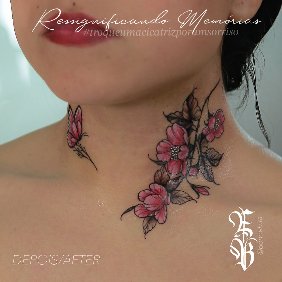 Tatuagem reparadora em cicatriz de origem cirúrgica na região do pescoço, com apresentação hipertrófica e hipercromia com design floral e borboleta. Foto acervo particular profissional Elvira Bono