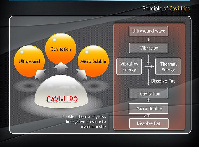 Process of how Cavi-lipo works