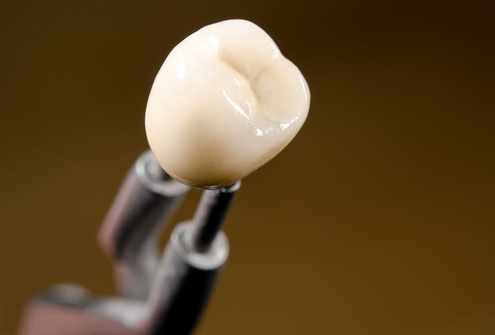 Dental Crown
