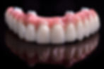 model of zircon dental implants used at The Center for Adult Dentistry, Temecula dental implant specialist, Dr. Dave Cutts
