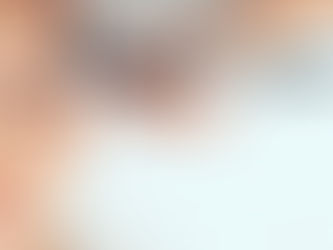 woman receiving microneedling treatment for wrinkles on the side of her head near the eye