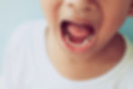 child with mouth open showing dental cavities