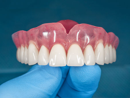 dentist holding upper dentures in his hand