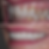 Patient shows straightened, whitened, natural-looking teeth thanks to Costa Mesa cosmetic dentist, Dr. Spitzer