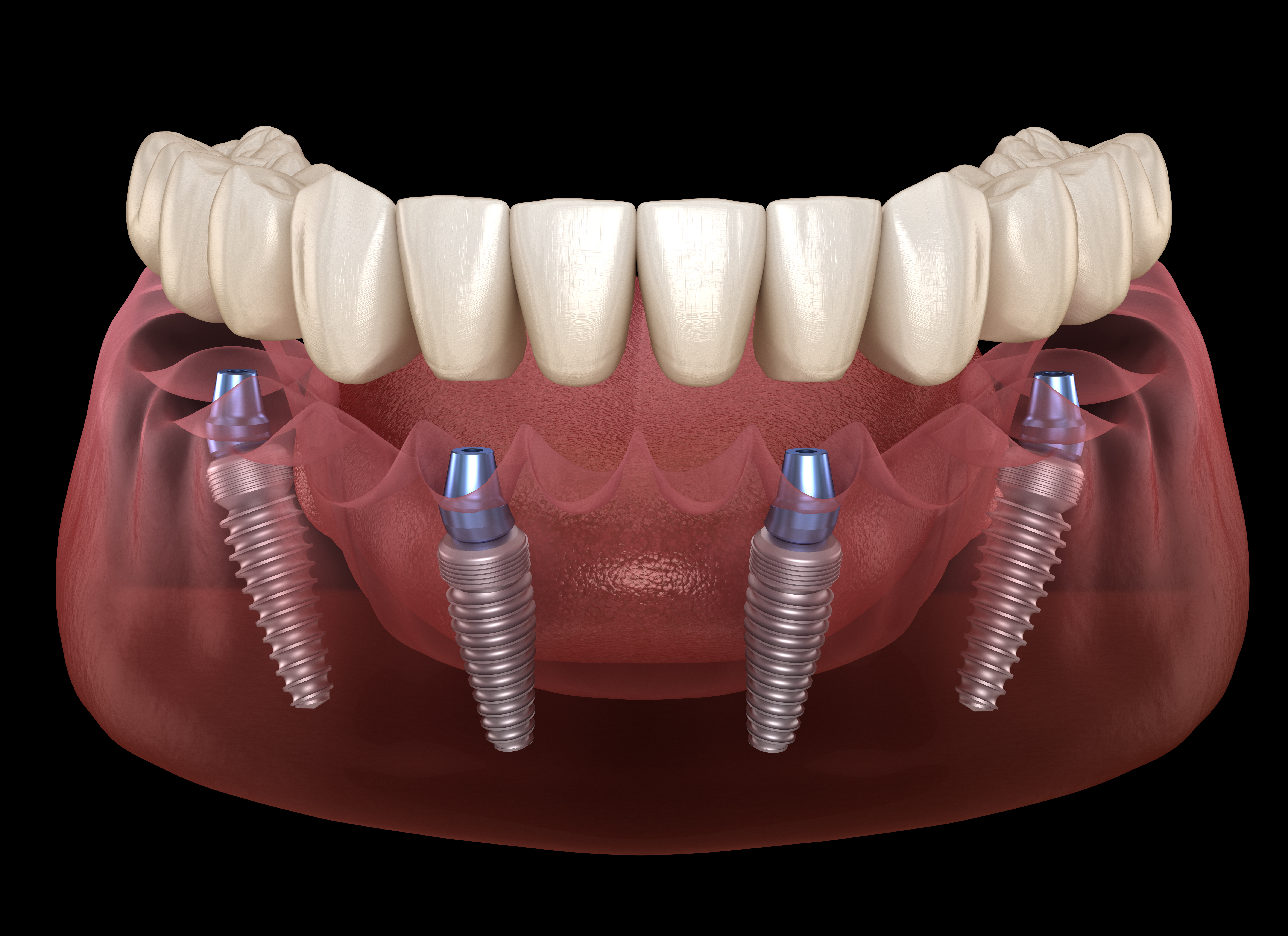 cone-beam-3d-imaging-planning.jpg