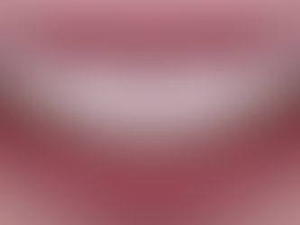 Rendering of smile with digital overlay so patient can see results before procedure