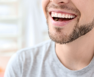 dentbond smile