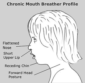 child mouth breather.jpg