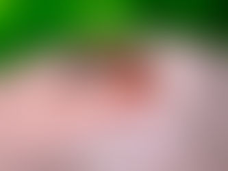 Dengue avança em Cachoeira: 1.159 casos e 1 óbito em 2024