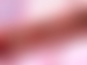 La terapia de quelación es el método más efectivo para tratar la arteriosclerosis