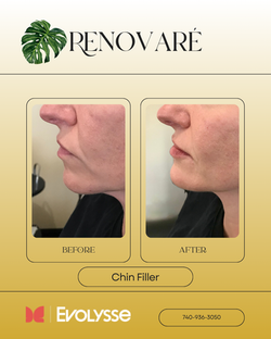 Facial Balancing