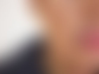 Cambios en la piel durante el posparto