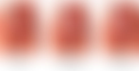 Cuando el bebé está posicionado de nalgas