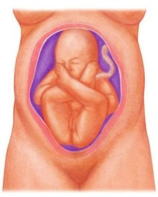 Cuando el bebé viene de nalgas