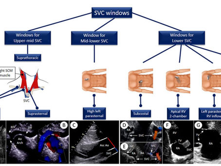 IMAGEN POR USG DE LA VENA CAVA SUPERIOR. ESTADO DEL ARTE