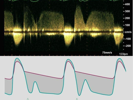 RESPUESTA TRIVIA DE LA SEMANA