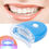 Thumbnail: SmileBeam™ Beauty LED Tooth Instrument