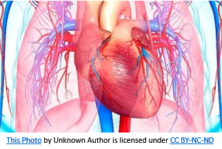 Pulmonary hypertension in ROS1+ patients on TKIs
