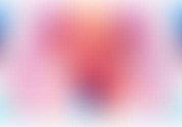 Pulmonary hypertension in ROS1+ patients on TKIs