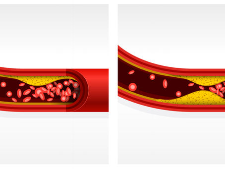 コレステロール高いんですよ!