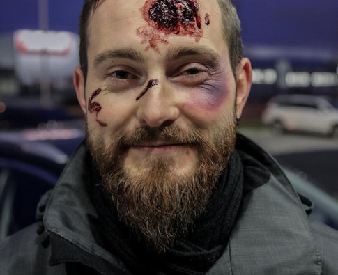 realistické maskování zranění na kurzu 1. pomoci opravdovým zážitkem PrPom Praha