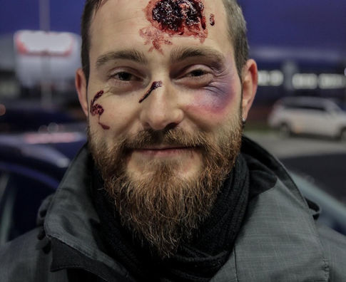 realistické maskování zranění na kurzu 1. pomoci opravdovým zážitkem PrPom Praha