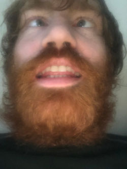 Cross Eyes & Hope To See...