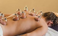 cupping.jpg